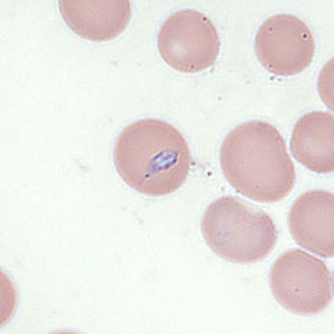 Case354_D.jpg Figure D