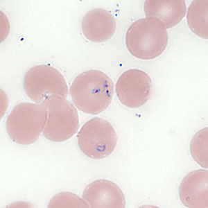 Case354_E.jpg Figure E