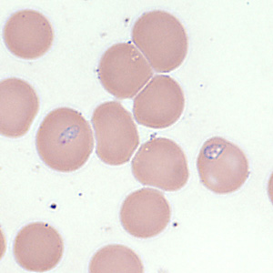 Case354_F.jpg Figure F