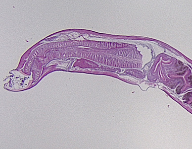 September - 2013 - Case #355 A worm-like object was removed during a routine colonoscopy performed on a 65-year-old male patient. The patient had no gastrointestinal complaints and no documented international travel.