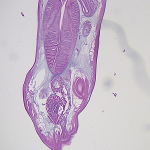 Case355_B.jpg Figure B