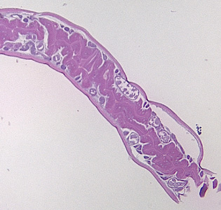 Case355_C.jpg Figure C