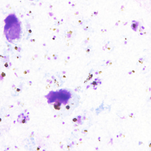 Case357_B.jpg Figure B