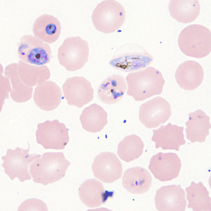 Case357_E.jpg Figure E