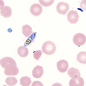 Case357_F.jpg Figure F