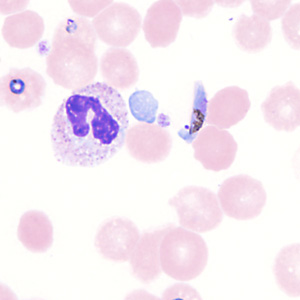 Case357_G.jpg Figure G