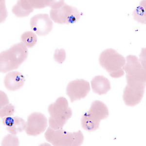 Case357_H.jpg Figure H