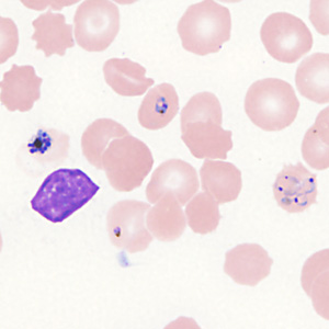 Case357_I.jpg Figure I