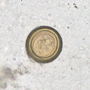 Case358_B.jpg Figure B