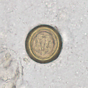 Case358_C.jpg Figure C