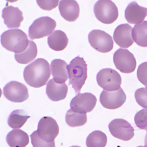 Case359_D.jpg Figure D