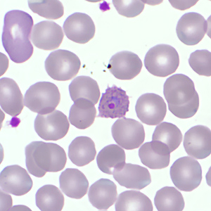 Case359_E.jpg Figiure E