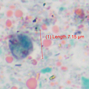 Case360_B.jpg Figure B