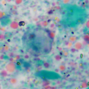 Case360_C.jpg Figure C