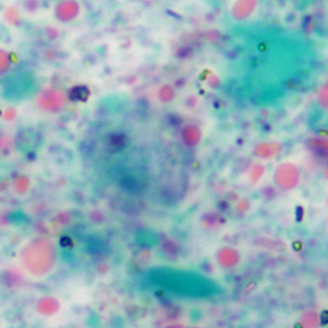 Case360_D.jpg Figure D