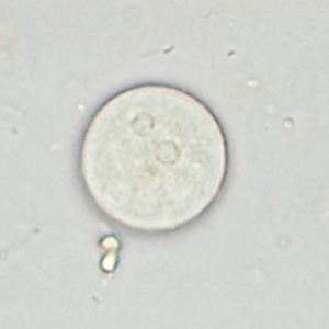 Case361_B.jpg Figure B