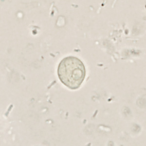 Case361_D.jpg Figure D