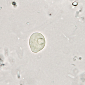 Case361_E.jpg Figure E