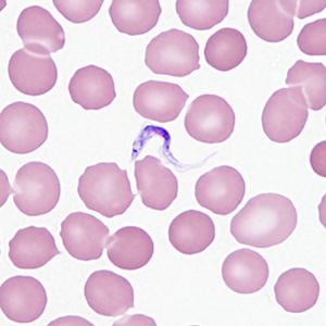 December - 2013 - Case #362 A 29-year-old female post-graduate student in Zoology went on an expedition to see the lowland gorillas in the Democratic Republic of Congo. She reported numerous insect bites while traveling but did take anti-malarial prophylaxis.