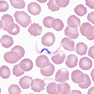 Case362_B.jpg Figure B