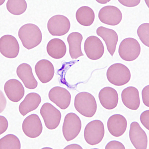 Case362_C.jpg Figure C