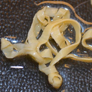 Case363_B.jpg Figure B