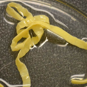 Case363_C.jpg Figure C