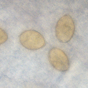 Case363_E.jpg Figure E