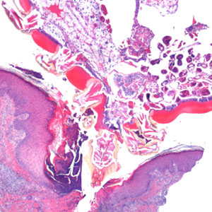 Case364_B.jpg Figure B