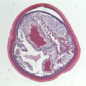 Case364_C.jpg Figure C