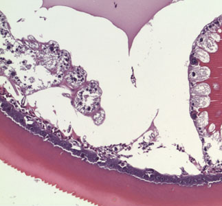 Case364_D.jpg Figure D