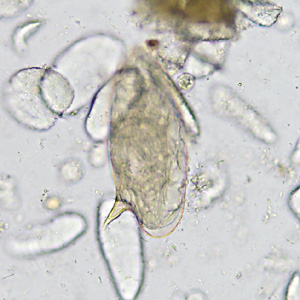 Case365_B.jpg Figure B