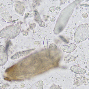 Case365_C.jpg Figure C