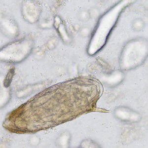 Case365_D.jpg Figure D