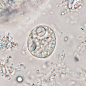 Case365_E.jpg Figure E