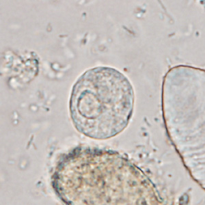 Case365_F.jpg Figure F