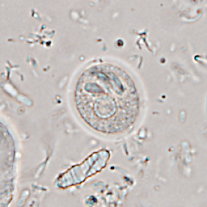 Case365_G.jpg Figure G