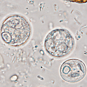 Case365_H.jpg Figure H