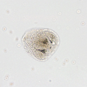 Case366_A.jpg Figure A