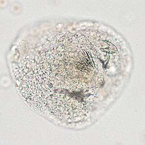 Case366_B.jpg Figure B