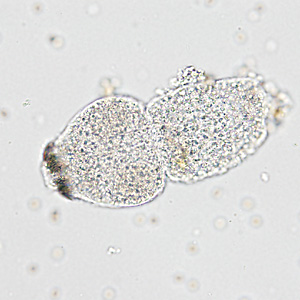 Case366_C.jpg Figure C