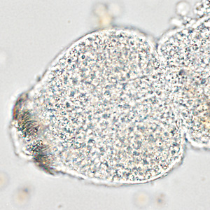 Case366_D.jpg Figure D