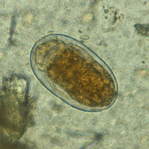 Case367_A.jpg Figure A