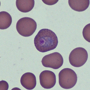 Case368_B.jpg Figure B