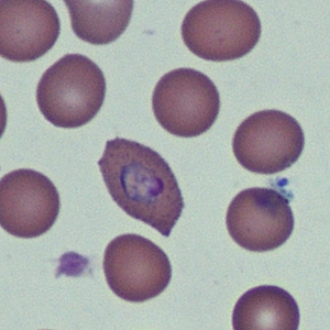 Case368_D.jpg Figure D