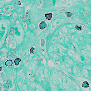 Case369_B.jpg Figure B