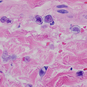 Case369_C.jpg Figure C