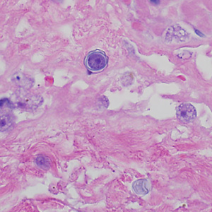 Case369_D.jpg Figure D