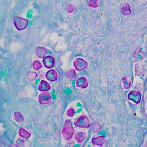 Case369_E.jpg Figure E