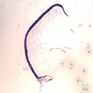 Case370_B.jpg Figure B